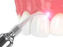 new philadelphia, oh dentist