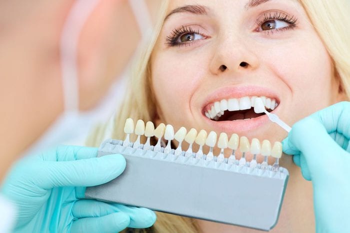 porcelain veneers benefits in New Philadelphia Ohio